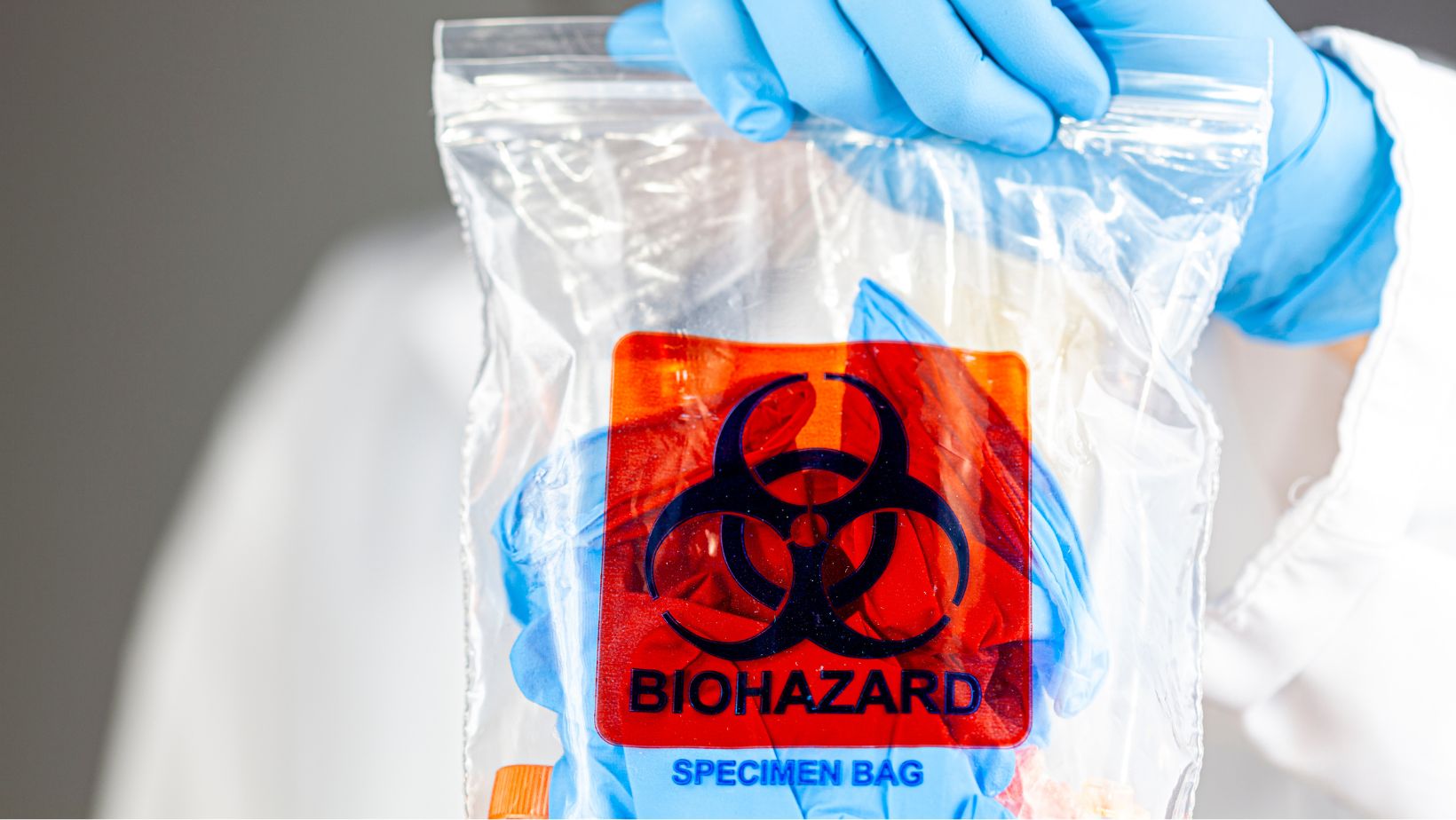 A person with gloves holding a biohazard specimen bag